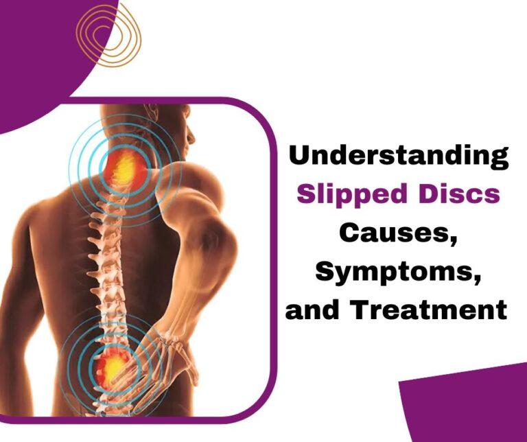 Slipped Disc Causes, & Treatment Painmedic Pain Clinic
