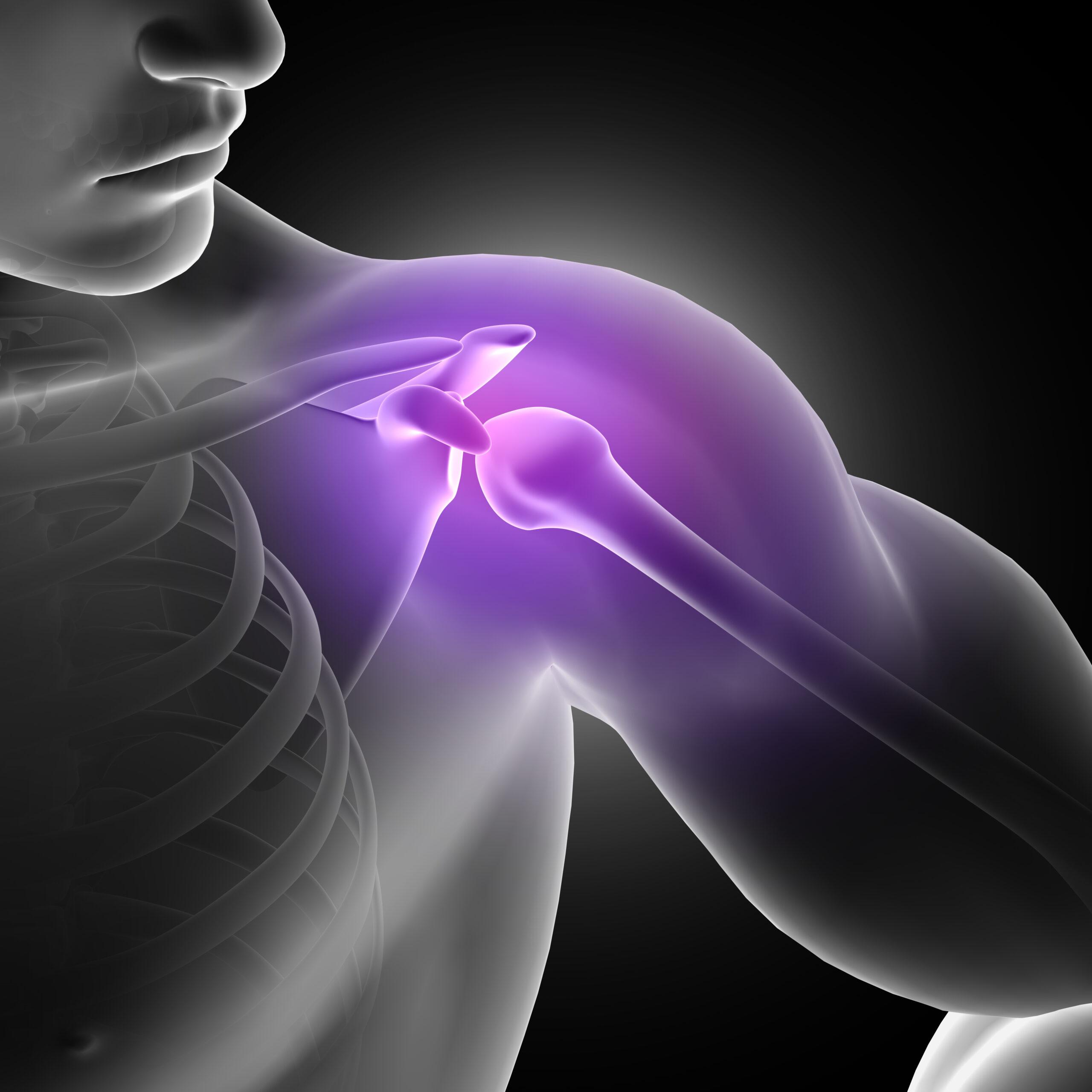 Shoulder Pain Specialist Doctor in Pune