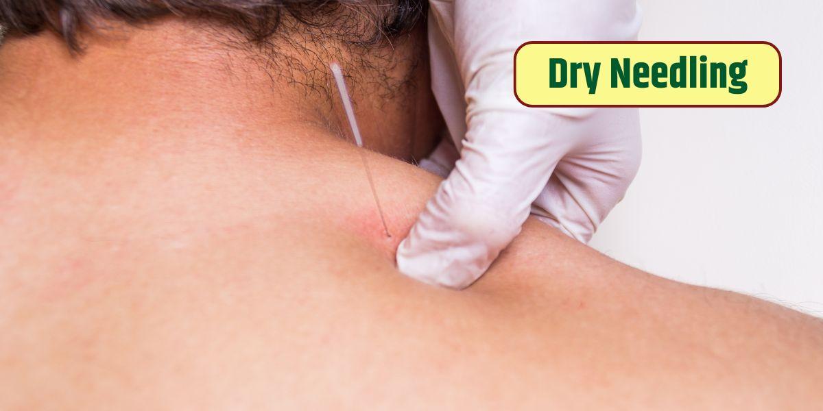 What is Dry Needling ?